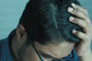 quel-traitement-pour-les-pellicules